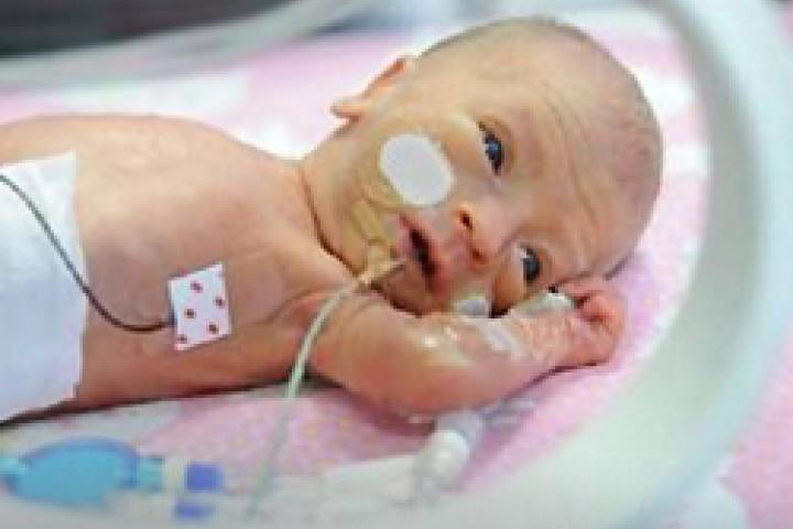Photo of baby in neonatal intensive care unit with feeding tube and monitors attached