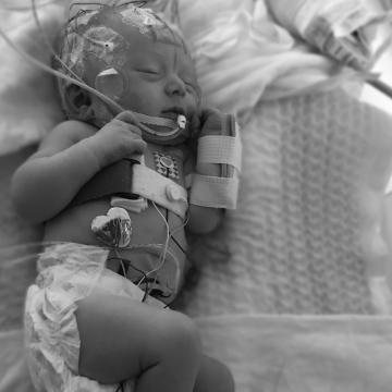 Two month old baby in incubator in the NICU