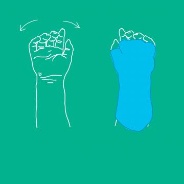 Outline of a hand next to hand in cast, illustrating movement constrained therapy